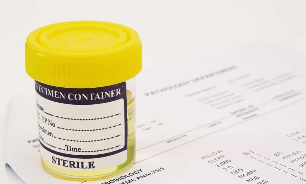 Enne antibiootikumide võtmist peate tegema uriinianalüüsi